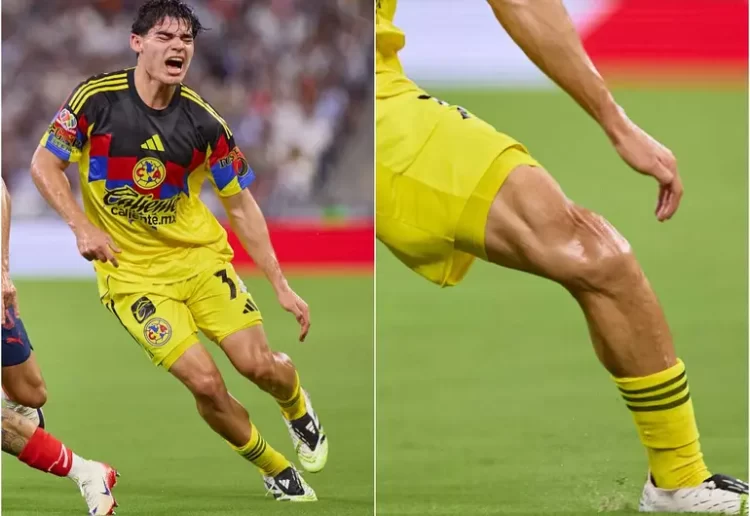 América confirma las peores noticias para Dagoberto Espinoza