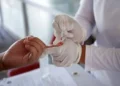 Detecta IMSS Chiapas hepatitis de forma portuna para evitar complicaciones